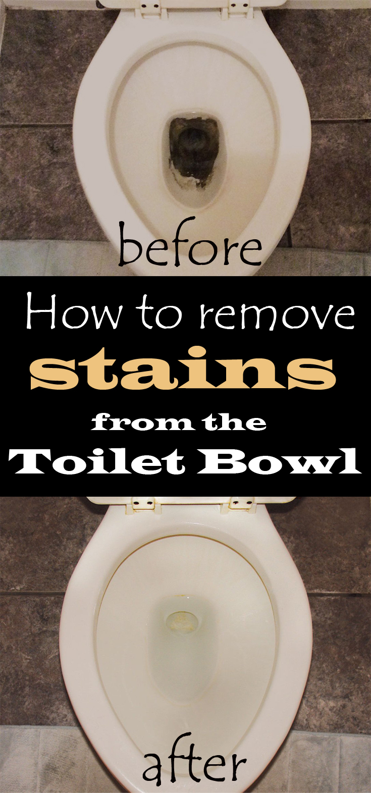 How to remove stains from the toilet bowl
