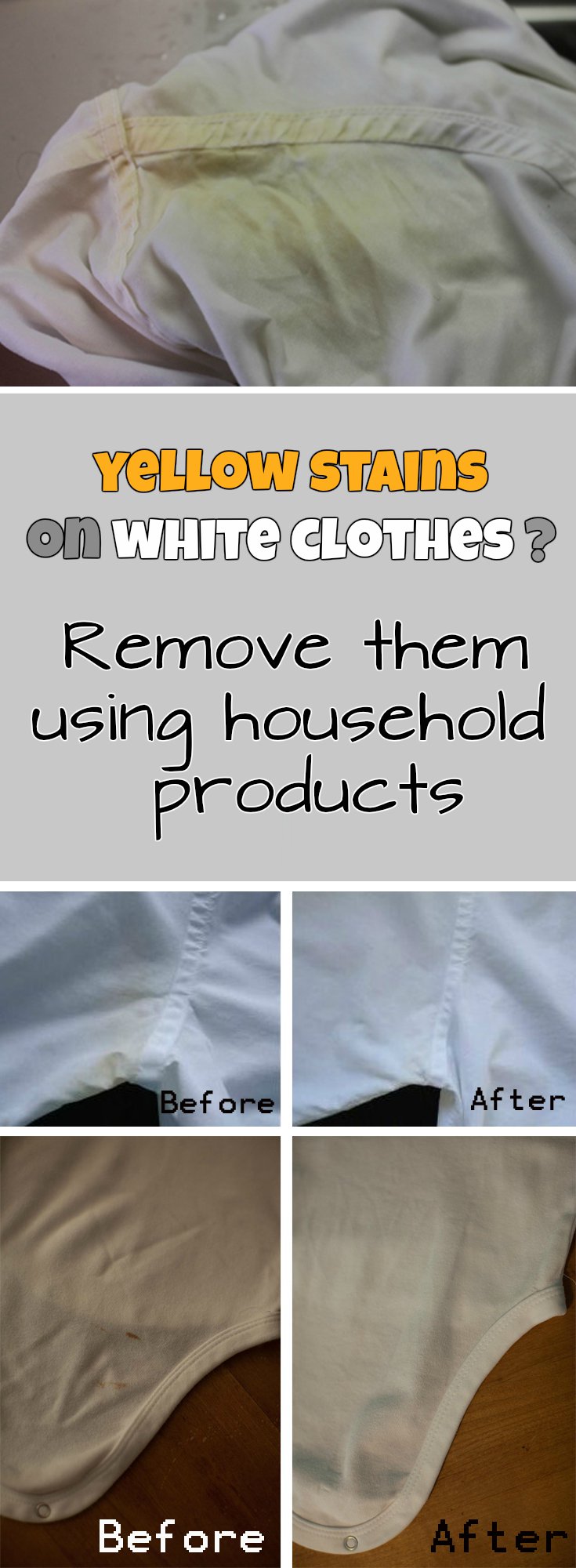 Yellow stains on white clothes? Remove them using