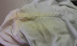 Yellow stains on white clothes? Remove them using household products!
