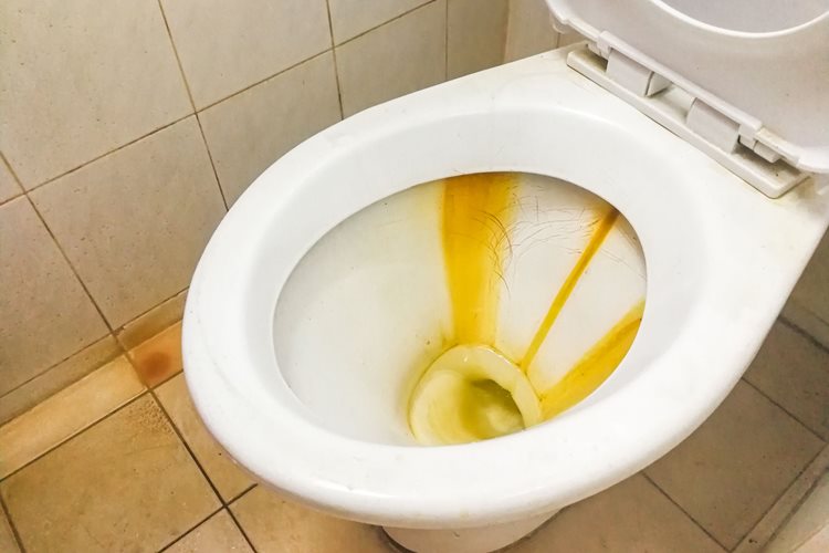 Quick And Simple! Chemical-Free Method To Remove Rust Stains From Sanitary Ware